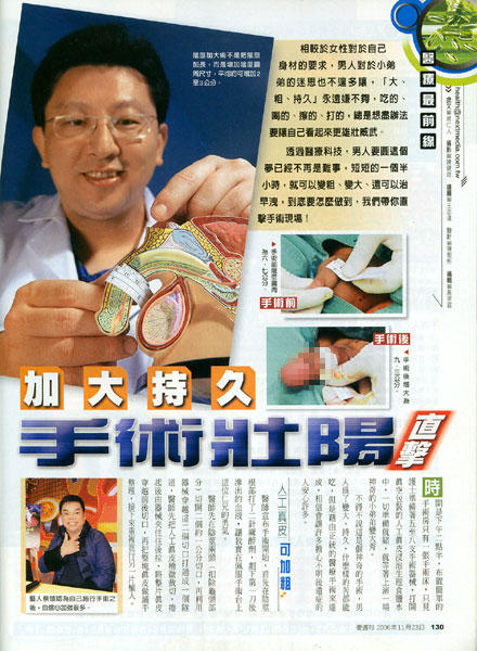 陰莖增大陰莖增長李久恆醫師 陰莖增大陰莖增長李久恆醫師