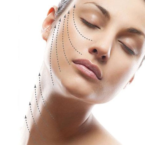 6D玫瑰線雕埋線拉皮 6D玫瑰線雕埋線拉皮