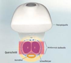 線性震波治療7.jpg 線性震波治療7.jpg