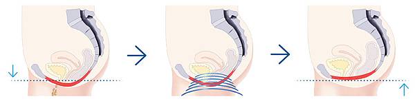 G動椅,G動椅評價,G動椅價錢,G動椅費用,G動椅ptt