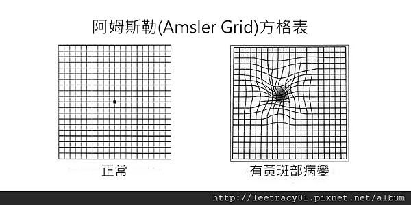 Amsler-Grid-2