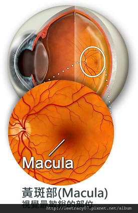 macula黃斑部病變