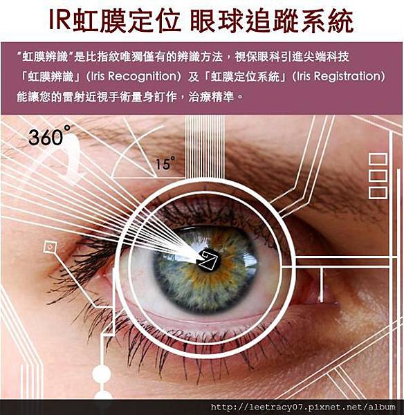 讓您的雷射近視手術量身訂作，治療精準。---視保眼科IR虹膜定位眼球追蹤系統.jpg