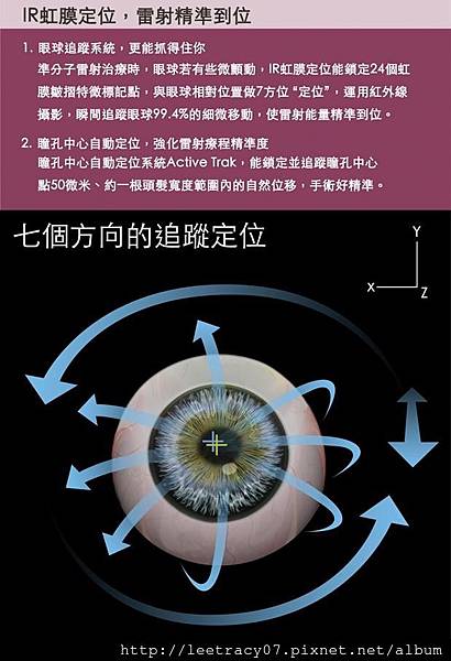IR虹膜定位眼球追蹤系統，更能抓得住你---視保眼科近視雷射精準到位.jpg