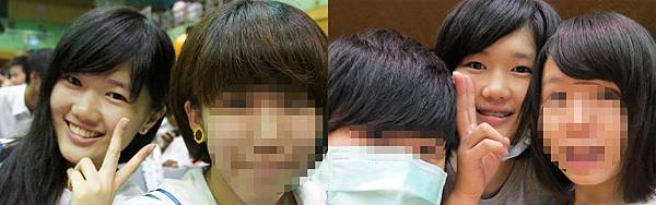 術前2.jpg 術前2.jpg