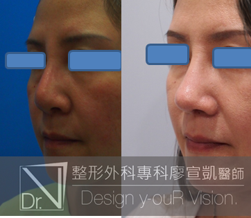 1488349007-940760978.png 1488349007-940760978.png