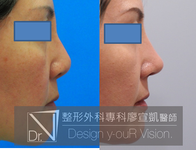 1488349380-65409453.png 1488349380-65409453.png