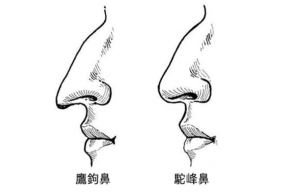 駝峰鼻 鷹鉤鼻.jpg 駝峰鼻 鷹鉤鼻.jpg