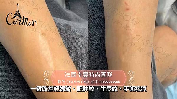 卡蔓台中SOBER SKIN.mpg_20220816_161805.054.jpg