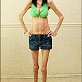 Lizzie Velasquez (1)