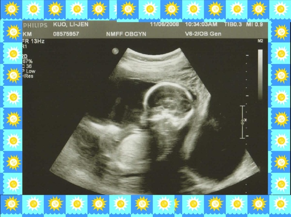 Baby Lo - 22 weeks.jpg Baby Lo - 22 weeks.jpg