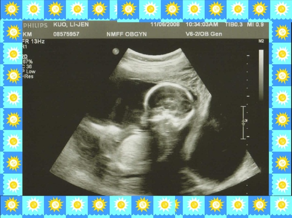 Baby Lo - 22 weeks.jpg