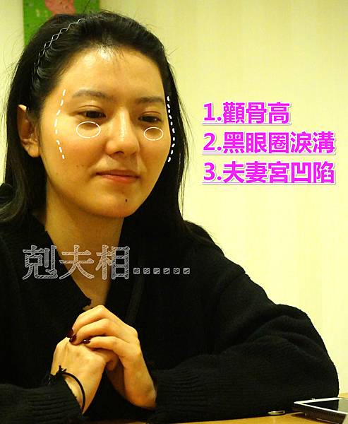 削骨推薦 削骨推薦