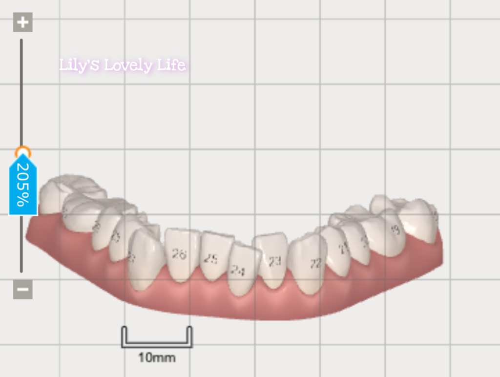 矯正前_Fotor.png 矯正前_Fotor.png