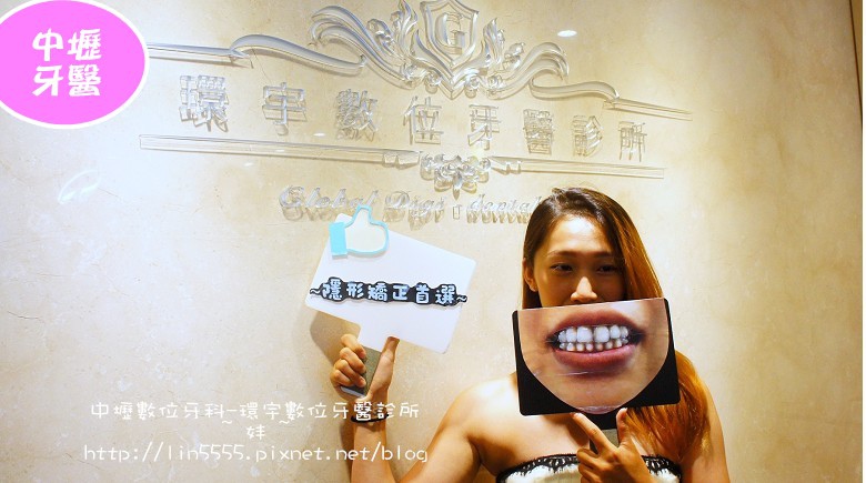 矯正牙齒隱形矯正中壢數位牙科-環宇數位牙醫診所2.jpg 矯正牙齒隱形矯正中壢數位牙科-環宇數位牙醫診所2.jpg