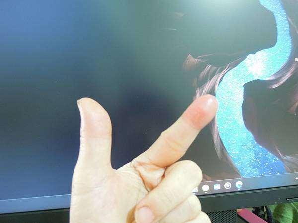 被蜂螫到，好痛啊！