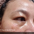 BFFECT Revi抗皺眼部精華6.jpg