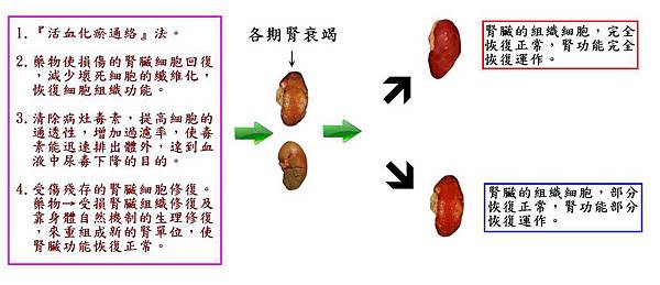 20170112我們醫院腎臟治療法8.JPG