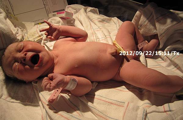 09/22-5醫護人員先幫忙新生兒做處置,初步檢查一下肢體與健康狀況.