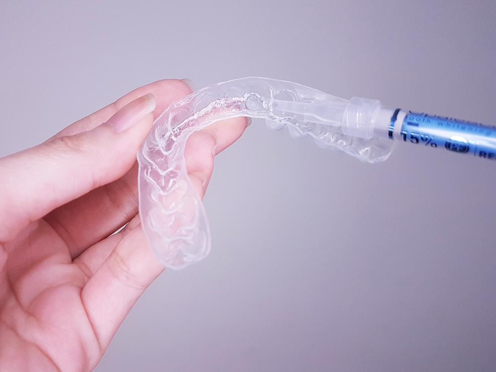 臺北士林悅庭牙醫診所-牙齒美白居家美白雷射美白30.jpg 臺北士林悅庭牙醫診所-牙齒美白居家美白雷射美白30.jpg