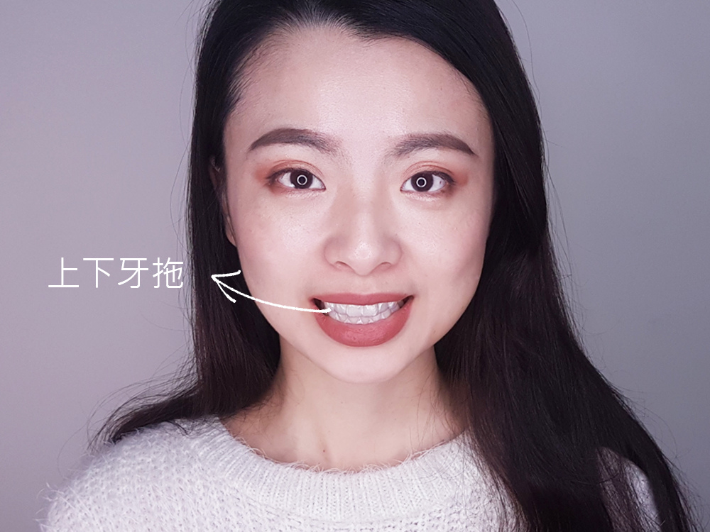 臺北士林悅庭牙醫診所-牙齒美白居家美白雷射美白34.jpg 臺北士林悅庭牙醫診所-牙齒美白居家美白雷射美白34.jpg