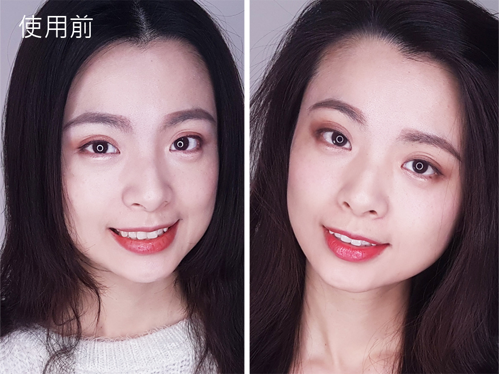 臺北士林悅庭牙醫診所-牙齒美白居家美白雷射美白40.jpg 臺北士林悅庭牙醫診所-牙齒美白居家美白雷射美白40.jpg