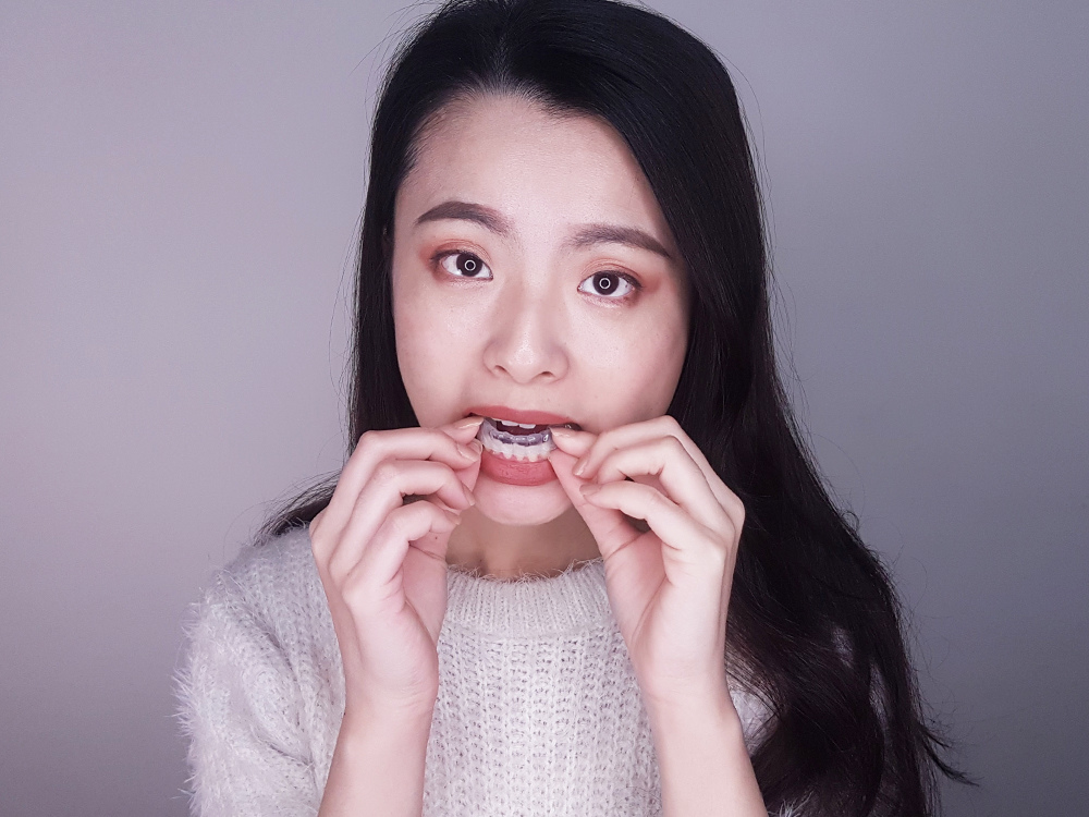 臺北士林悅庭牙醫診所-牙齒美白居家美白雷射美白32.jpg 臺北士林悅庭牙醫診所-牙齒美白居家美白雷射美白32.jpg