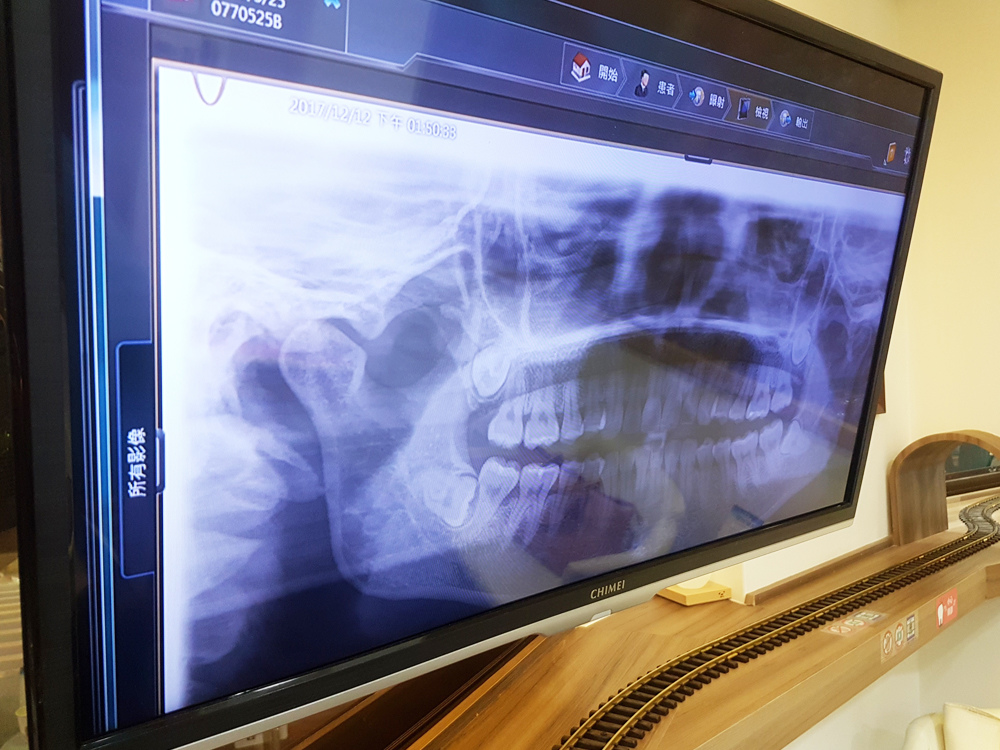 臺北士林悅庭牙醫診所-牙齒美白居家美白雷射美白7.jpg 臺北士林悅庭牙醫診所-牙齒美白居家美白雷射美白7.jpg