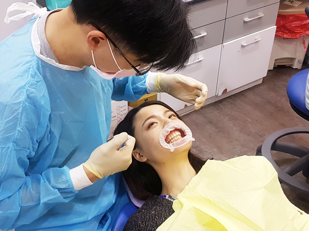 臺北士林悅庭牙醫診所-牙齒美白居家美白雷射美白15.jpg 臺北士林悅庭牙醫診所-牙齒美白居家美白雷射美白15.jpg