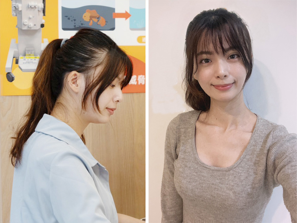 佳亚诊所-丽芙 优芙纳音波拉提机推荐-脸部拉提-女神制造机28.jpg