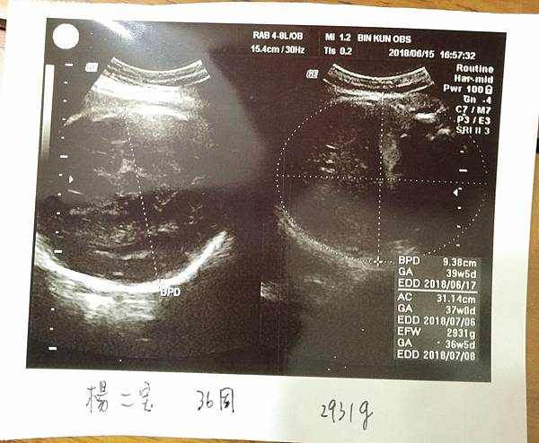 36周.jpg