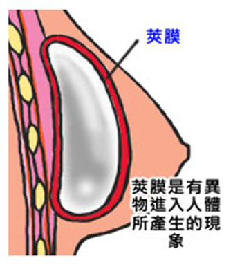 內置圖片 2