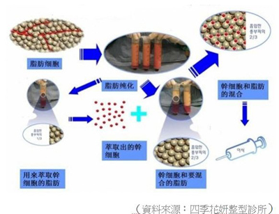 內置圖片 3