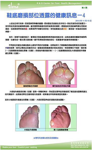 足部健康電子報第4期