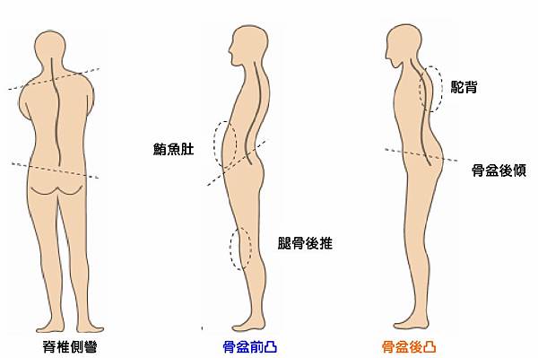 腳與身體酸痛-5-1