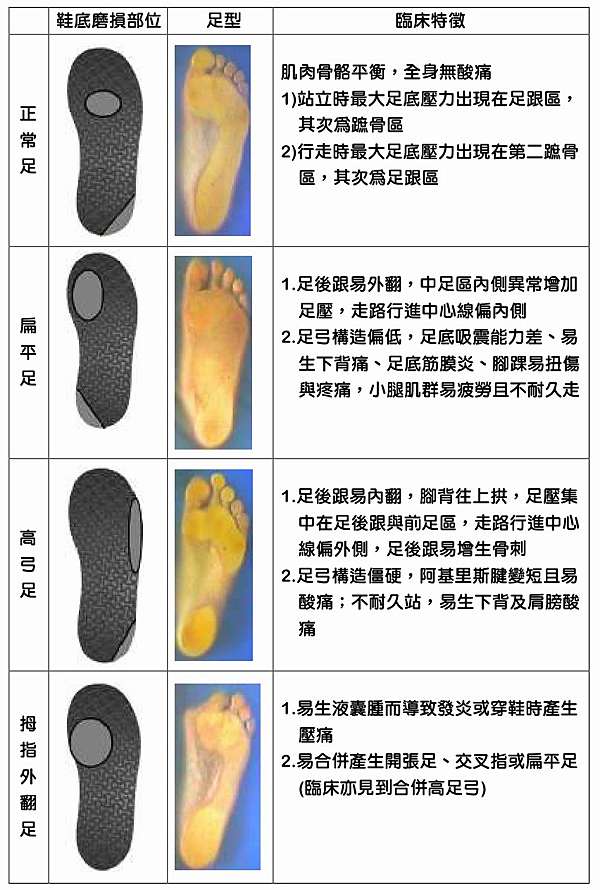 足部健康電子報第二期-鞋底磨損部位透露的健康訊息2 @ 足部健康管理 型番 2足 スニーカー