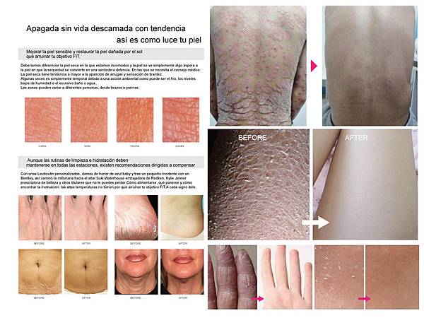 Report_dryskin_20151103