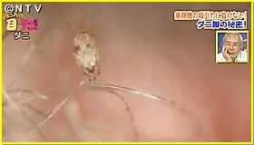 ダニ繊維絡む ダニ繊維絡む
