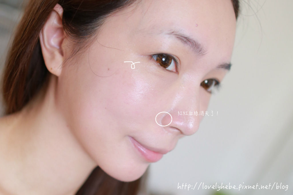 星采大安_櫻花雷射_小季20 星采大安_櫻花雷射_小季20