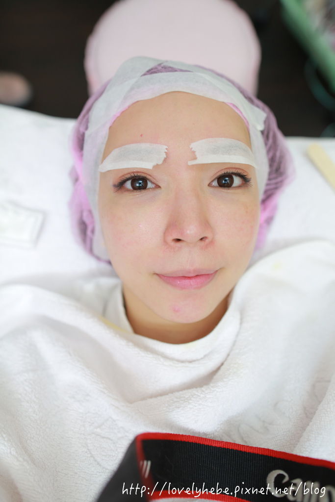 星采大安_櫻花雷射_小季12 星采大安_櫻花雷射_小季12