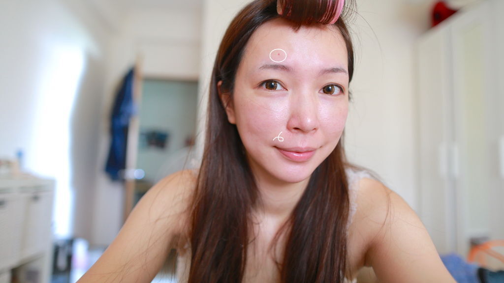 星采大安_櫻花雷射_小季02 星采大安_櫻花雷射_小季02