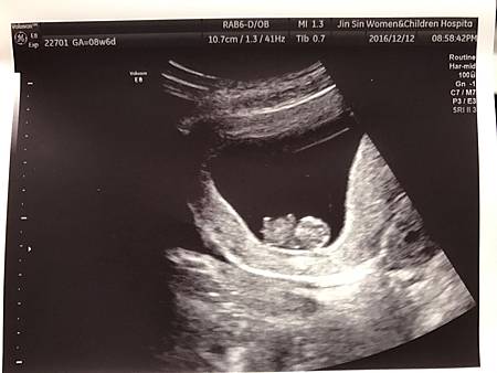 台南璟馨婦幼醫院,璟馨醫院,婦產科,兒科,台南婦產科,月子中心,媽媽經,孕婦,產婦,自然產 台南璟馨婦幼醫院,璟馨醫院,婦產科,兒科,台南婦產科,月子中心,媽媽經,孕婦,產婦,自然產