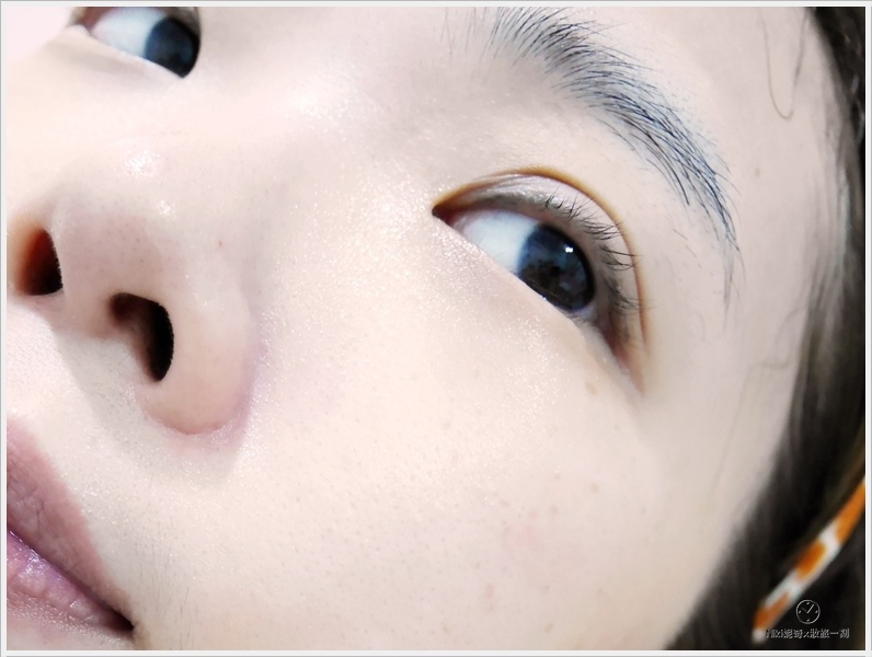 Dr Hsieh 杏仁酸煥膚 (27).JPG Dr Hsieh 杏仁酸煥膚 (27).JPG