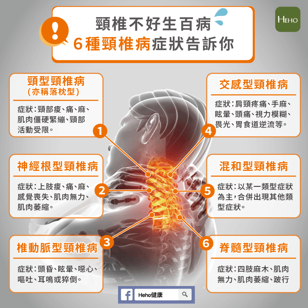 頸椎症候群