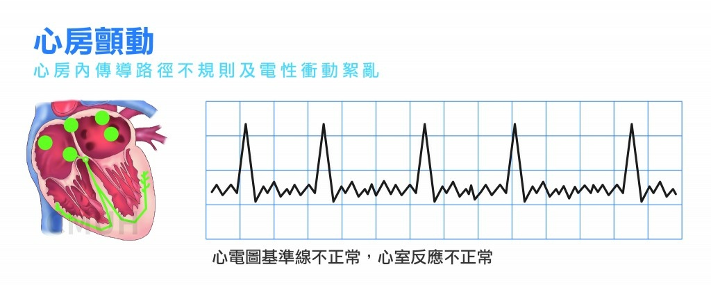 心律不整-01-1024x411.jpg