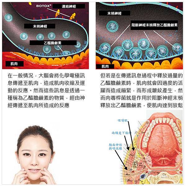 凝膠式玻尿酸豐唇肉毒桿菌瘦小臉G