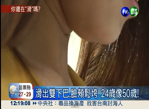 低頭族手機成癮智慧型手機雙下巴臉頰鬆垮Ultherapy極限音波拉皮液態拉皮02.jpg 低頭族手機成癮智慧型手機雙下巴臉頰鬆垮Ultherapy極限音波拉皮液態拉皮02.jpg