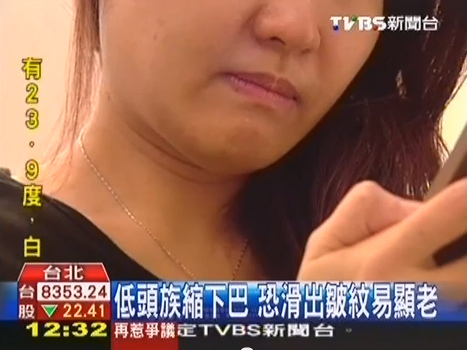 低頭族手機成癮智慧型手機雙下巴臉頰鬆垮Ultherapy極限音波拉皮液態拉皮03.jpg 低頭族手機成癮智慧型手機雙下巴臉頰鬆垮Ultherapy極限音波拉皮液態拉皮03.jpg