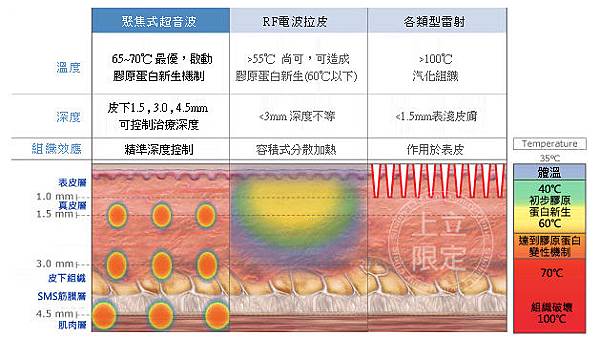 林上立 推薦 液態拉皮 推薦 極線音波拉皮 推薦 極限音波拉皮 推薦 筋膜拉皮 推薦 超音波拉皮 推薦 超音波拉皮 推薦 上立皮膚科 下垂 鬆弛 老化 治療 Ulthera™ 極線音波拉皮09