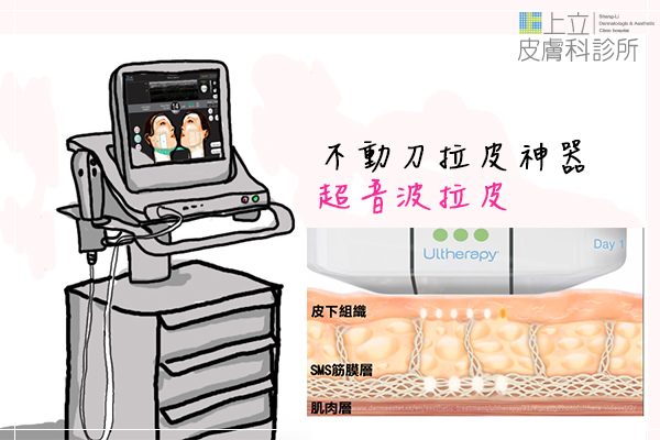 上立皮膚科 費用 林上立 價格 林上立 評價 林上立 超音波拉皮 超音波拉皮 費用 超音波拉皮 價格 超音波拉皮 會不會痛 Ulthera™ 極線音波拉皮 極限音波拉皮 筋膜拉皮03.jpg 上立皮膚科 費用 林上立 價格 林上立 評價 林上立 超音波拉皮 超音波拉皮 費用 超音波拉皮 價格 超音波拉皮 會不會痛 Ulthera™ 極線音波拉皮 極限音波拉皮 筋膜拉皮03.jpg